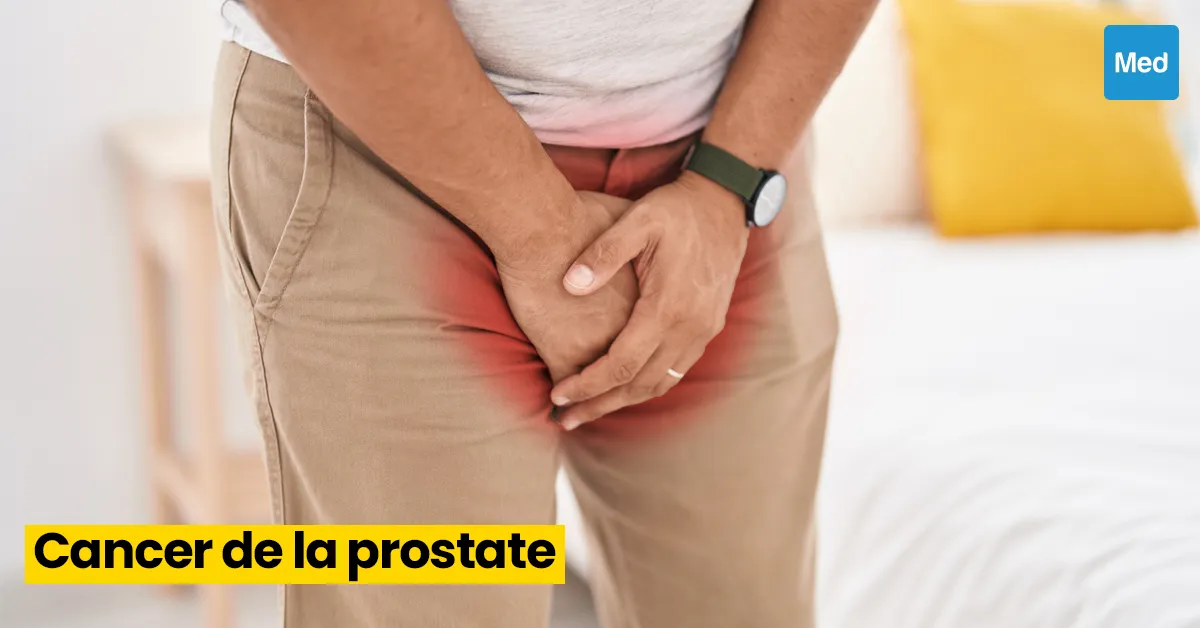 Comprendre et Gérer le Cancer de la Prostate 